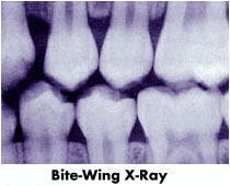 xray1.jpg (11422 bytes)