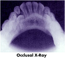 xray2.jpg (10671 bytes)