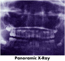 xray3.jpg (12666 bytes)