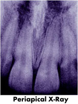 xray4.jpg (10814 bytes)